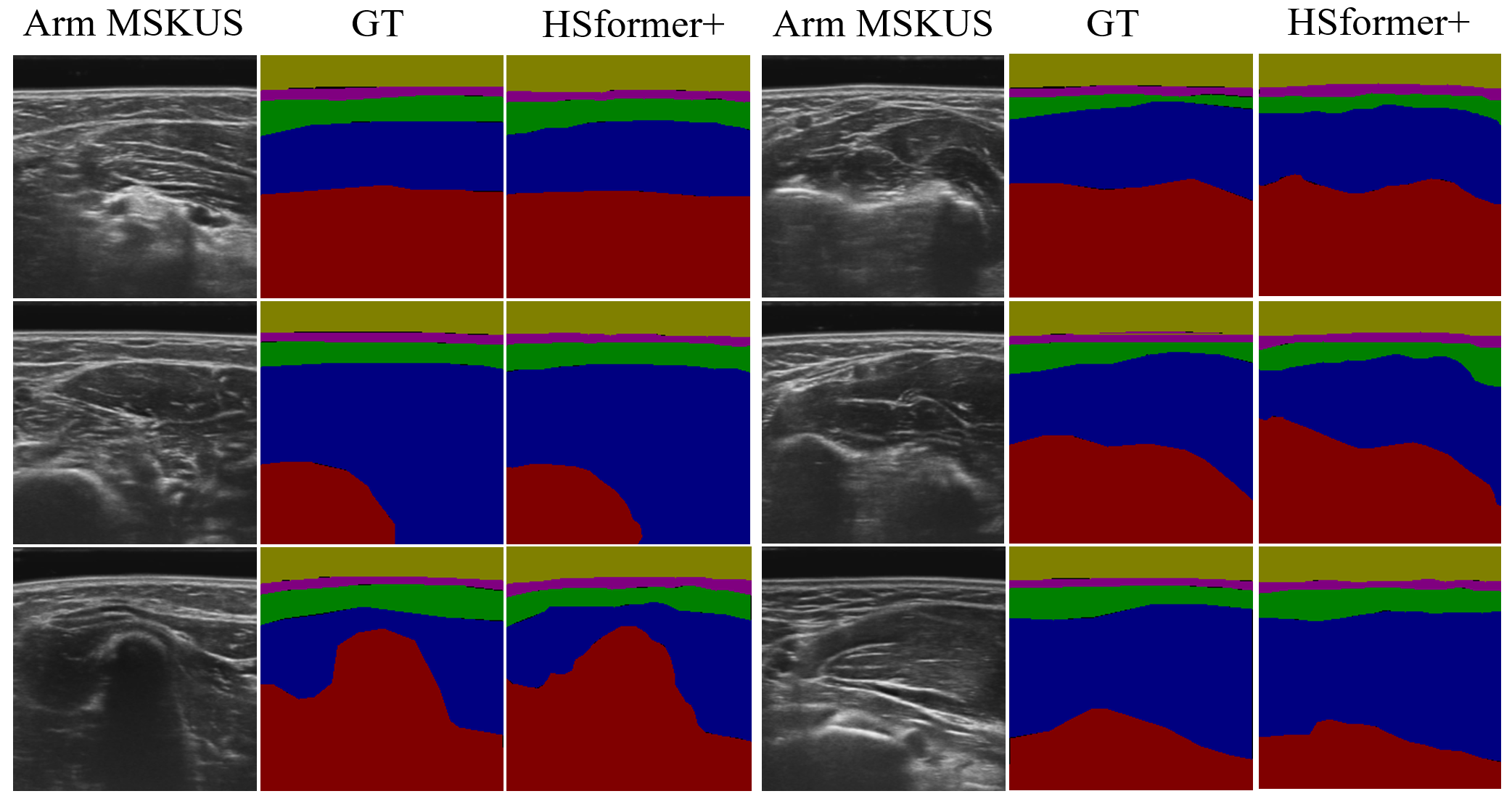 Results on private MSKUS dataset